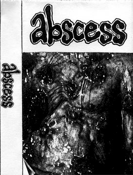 Abscess