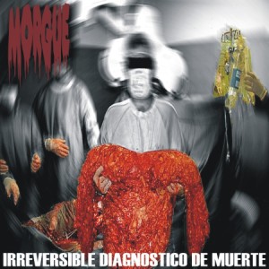 Irreversible Diagnstico De Muerte